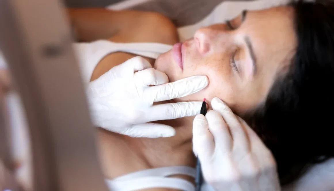 Epilation Haute frequence joue femme epilation definitive electrolyse, haute frequence essence yelle montpellier