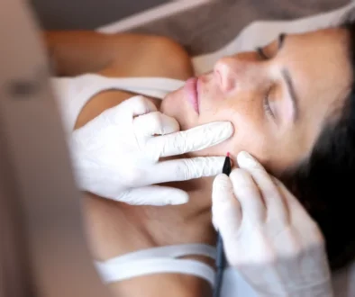 Epilation Haute frequence joue femme epilation definitive electrolyse, haute frequence essence yelle montpellier