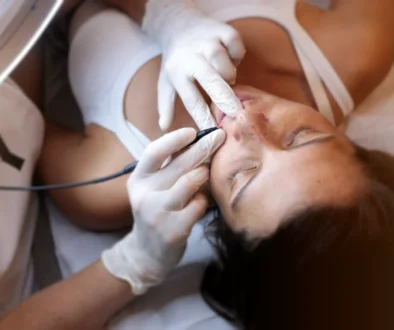 Epilation Haute frequence moustache arriere femme epilation definitive electrolyse, haute frequence essence yelle montpellier